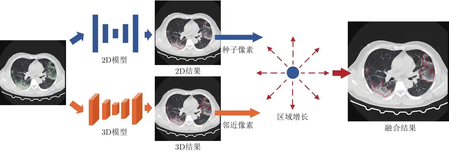 病灶检测结果展示，红色标记显示检测到的病变区域