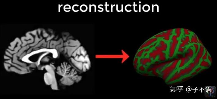 医学影像3D重建结果，显示器官的三维结构